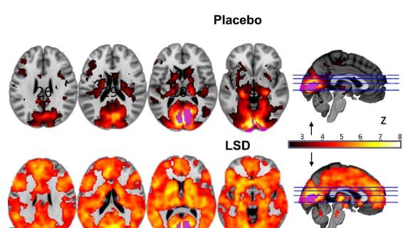 Brain LSD